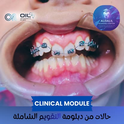 حالة سريرية من دبلومة تقويم الأسنان
